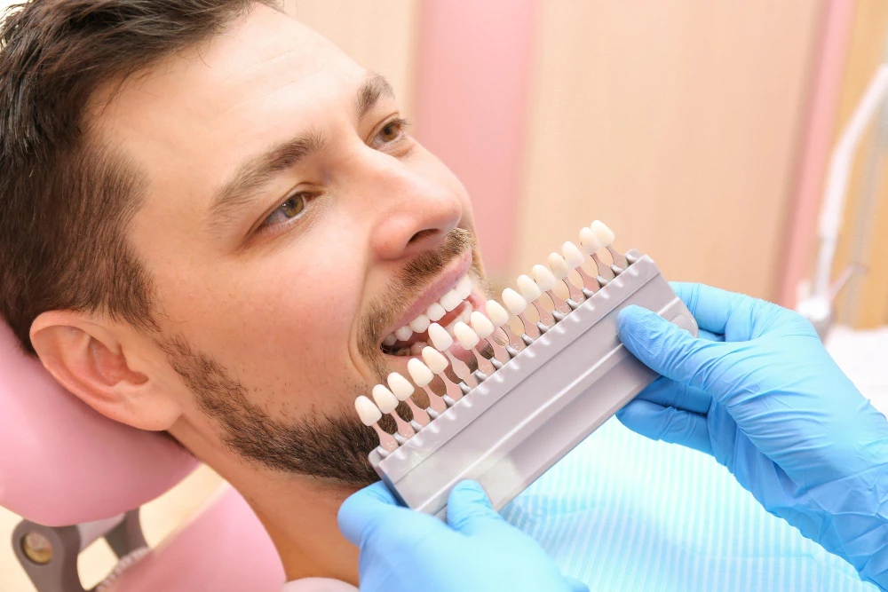 Dental Veneers in Dubai